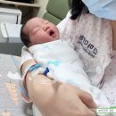11260-2-37-12 | 임신 37주 1일 인하대병원 전치태반 제왕절개 하반신마취 생생후기