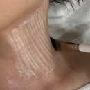 수라 | 홍조&amp;여드름 잘 잡는 신촌피부관리실 수라움에스떼 다녀온 후기