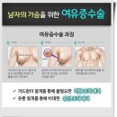 여유증수술후기 고민이신가요?