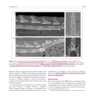 고양이에서 발생하는 discospondylitis의 방사선, CT, MRI의 특징과 각 modality의 민감도 이미지