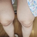 마마스휴게실 | [공지] [출산 기록]❣️일산차병원 1인실(A) / 제왕절개 리얼 후기 / 비로소 엄마가 되어 나왔다🤱