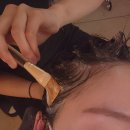 아미치0.3(부천상동점) | 부천 두피탈모관리 지루성두피염 두피 스케일링 추천 [모바이오]