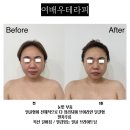 프엔느에스테틱 이미지