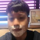 필스토리의원 | [전주남자수염제모]필스토리의원 악센토레이저 수염제모 1,2회차 리뷰후기(얼빡샷주의)