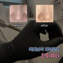 목포 남악 피부관리 “단미뷰티” 문제성 피부 여드름 관리