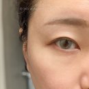 제로플러스 위드렌즈 남포점 이미지