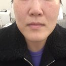 시바산 메쓰크림으로 시조피린 피부관리받은 쌍문역 늘품 에스테틱