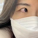 유망안과의원 | [강서안과/등촌안과/마곡안과] 유망안과의원 결막모반제거 후기 (feat.내돈내산)