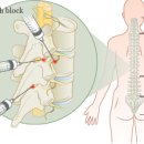 삼성탑마취통증의학과의원 | 일자목,디스크 마취통증주사의 '항염' 치료 효과 - 삼성탑마취통증의학과의원