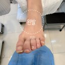 덕소메디칼약국 | 구리 남양주 문제성 발관리 : 발각질제거, 내성발톱, 무좀 등..남양주 레푸스 다산점, 구로점