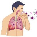 중동 호흡기 증후군[(MERS)Middle East Respiratory Syndrome]감염성 질환, 호흡기질환 이미지