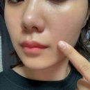 바이 플라즈마 콜라겐 크림 효과 총정리