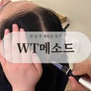 [WT메소드 서울대점] 두피탈모케어 전문센터 재방문 후기┃주차, 가격