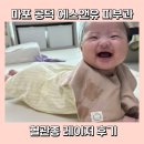 유아 혈관종 레이저 1회차 후기 마포 공덕 에스앤유 주차