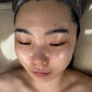 썬더치킨 덕천시장점 | 부산 온천장 윤곽관리 전문 에스테틱샵 루메이에스테틱 (슈퍼젝션 관리 솔직 후기!)