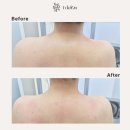더스무스 스킨케어&amp;왁싱 인천송도 거북목 체형관리+속눈썹펌(재방문)