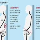 뱃살 없는데, 배 나와 보인다? '이것' 틀어졌을 수도 이미지