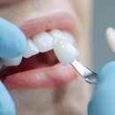 림플란트치과의원 이미지