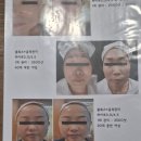 고운피부 - 전주시 완산구 꽃밭정로 71 | 목 어깨가 가벼워진 고운피부 블루엣 담백리얼 후기