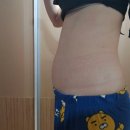 광주경희한의원 | [소양인다이어트] 체질다이어트 성공기 _경기광주한의원_경희체화담한의원