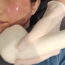 400 | 수원 광교 리프팅 피부과 : 올타이트리프팅 400샷 후기 ♩