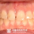 라이프치과기공소 이미지
