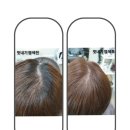 두피·탈모태후사랑하남점 이미지