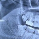 바른이치치과의원 이미지