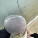 에이스컴퓨터 | 아기 사두증 교정헬멧 후기 | 3개월 두상스캔 → 5개월 진단 → 에이스밴드 착용 한달