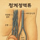 순천향대학교 내 | [내 첫 수술 이야기] 넝쿨정계정맥류 수술 후기 - 순천향대학교 천안병원에서