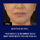 노블와이성형외과의원 이미지