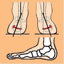 몸살림운동 이미지