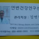 비숀