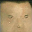 개미똥구멍 이미지