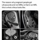 임산부가 MRI 검사 대신 초음파 검사를 받는 이유 이미지