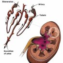 Kidney failure, chronic 이미지