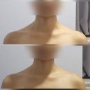 탐날에스테틱 창원점 | 창원에스테틱 상남동피부관리 추천 <탐날에스테틱 창원점> 데콜테관리 맞춤 프로그램 후기