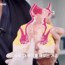 강남항외과의원 | 강남항외과 치칠 수술 방법 어떤 것이 좋을까요? PPH vs 리가슈어