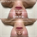숨에스테틱왁싱 | 울산 동구 피부관리 숨테라피 에스테틱 웨딩 윤곽 탄력 관리
