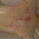 부평대로165번길 | 부평경락 에스테틱에서 이중턱, 승모근까지 한번에 정리한 후기 어깨,허리통증 확 풀린 리얼후기