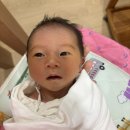 위례재활의학과병원 | 사두 일기(1) 140일 아기 사두 단두 판정 삼성 창원병원 재활의학과 방문 후기 / 두개골 조기유합 의심