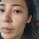 에스떼젠 - 북구 용봉동 | 광주용봉동 에스테틱 추천 🌿 에스떼젠에서 받은 진정 수분 아로마 동안관리 후기!