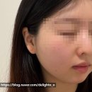작은지구 | 광주 끌리메 작은얼굴관리 후기 상무지구 신부관리 추천