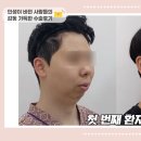 양윤돌구강악안면외과치과의원 | 양윤돌 수술 후 감동적인 리뷰 읽어보기!!