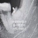 관악연세공감치과의원 네이버블로그