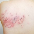 바로이비인후과의원 이미지