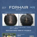 포헤어의원 | 대구모발이식 포헤어의원 비절개슬릿 정수리탈모 1년 전후