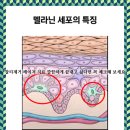 클린앤미의원 | 진천잡티제거 레이저 치료 깔끔하게 끝내고 싶다면 꼭 체크해 보세요