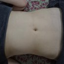 알파케어 | [달리스킨케어] 복부 라인 변화가 눈에 보였던 뉴로알파 재생테라피 후기