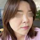 동일빌딩 | 여의도역 예약가능 피부과(호성빌딩 본관) - 올타이트+리투오 탄력 눈밑꺼짐 V라인 개선 후기